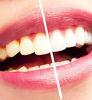 Odontología Estética