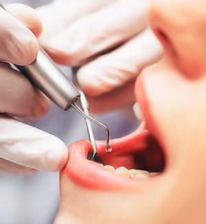 Periodoncia